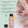 UltraGrow Nail Serum, Nail Growth Serum for Brittle Peeling Breaking Thin Nails, 1 fl.oz