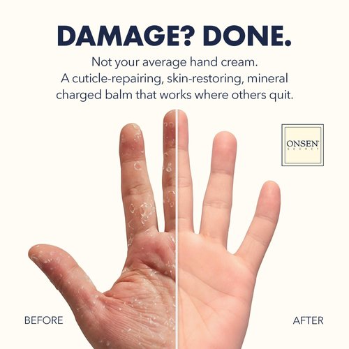 Onsen Nail & Cuticle Rescue Kit – Conditioner Serum, Repair Oil & Cuticle Balm – Tsubaki, Shea Butter, Jojoba – Strengthens Nails, Softens Cuticles, Hydrates Skin (15ml Serum + 10ml Oil + 26ml Cream)