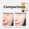 boticle 2PCS Gold Peel Off Mask, 2024 New Upgraded Gold Foil Peel-Off Mask, Gold Exfoliating Mask, Remove Blackhead Mask, Anti-Aging & Reduces Fine Lines