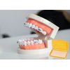 OBTANIM 15 Pack Colorful Braces Wax Dental Care Orthodontic Wax for Braces Wearer (10 Color)