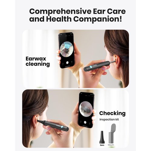 Ear Wax Removal Tool Camera,BEBIRD R1 Ear Camera Wax Removal,Ear Cleaner with Camera,1080P Hd Endoscope,Earwax Removal Kit with Camera,6 Led Lights Ear Picker with 10 Spoons for Ear Cleaning