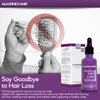 Almond Hair Growth Serum – 1-Pack Hair Regrowth Treatment for Women – Hair Serum for Hair Growth, Hair Thinning and Loss – Natural Henna Extract–Women’s Hair Growth Treatment for Damaged Hair (1 Pack)