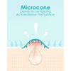 +1HEROLABS Microdart Acne Patch (18 Patches) - Hyaluronate, Salicylic Acid, Vitamin C, Microdart Pimple Patch for Deep, Early Stage and Hidden Pimples (18 Count (Pack of 1))