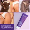 Seroflora Butt & Thighs Acne Treatment Cream - Butt Acne Clearing Cream for Pimples, Zits, Razor Bumps, Dark Spots - Acne Clearing Lotion for Buttocks & Body - Inner Thigh Blackhead Remover (4oz)