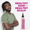 immetee Scalp hair oil, scalp treatment for dry itchy scalp, Scalp Care Anti-Itch for Natural and Curly Hair, 190Ml/6.42Fl Oz