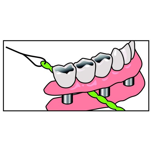 Idontix Dental Floss, Unflavored, Green, 1.0 Count