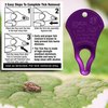 The Original Tick Key - Tick Detaching Device - Portable, Safe and Highly Effective Tick Detaching Tool (Purple)
