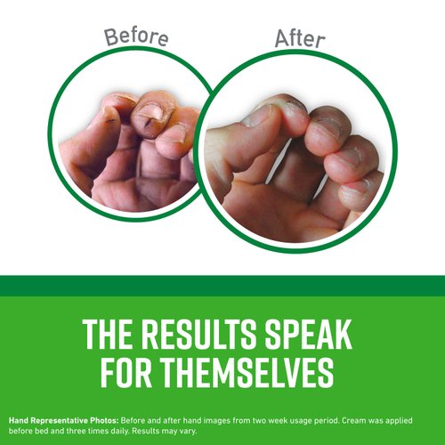 O'Keeffe's K0290004-7 Working Hands Hand Cream Tube (7 Pack), 3 oz