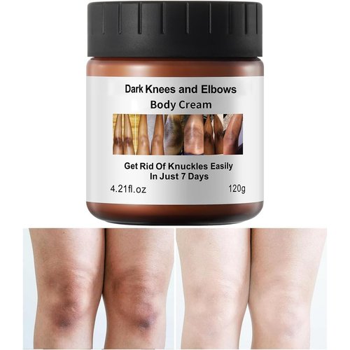 Dark Knees Remover Underarm Cream Body Moisturizer Lotion Dark Toe Knuckles Treatment Removal Remover Corrector for Armpit Elbow Inner Thigh Neck Private Part Intimate Legs Skin Cream - 120g/4.21oz