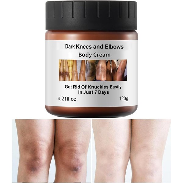 Dark Knees Remover Underarm Cream Body Moisturizer Lotion Dark Toe Knuckles Treatment Removal Remover Corrector for Armpit Elbow Inner Thigh Neck Private Part Intimate Legs Skin Cream - 120g/4.21oz