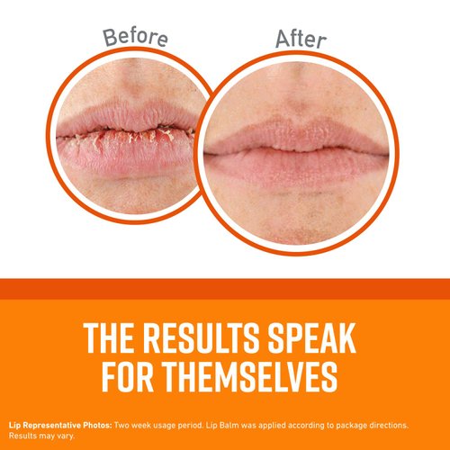 O'Keeffe's Unscented Lip Repair Lip Balm for Dry, Cracked Lips, Stick, (Pack of 4)