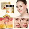 Bee Venom Cream, New Bee Venom Skin Treatment Cream, Professional Natural Bee Venom Repair Cream Gel, Bee Venom Skin Cream for All Parts of The Body (2 Pack)