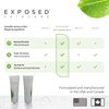 Exposed Skin Care Acne Treatment Serum Step 3 – Quickly Reduces Pimple Size and Redness - 12 Hour Spot Treatment - 3.5% Benzoyl Peroxide, Natural Green Tea & Tea Tree Oil