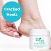 Banish My Callus Foot Callus Cream Hand Callus Remover – For Softening Rough Hard Dry Skin on Feet Hands Knees Elbows
