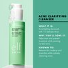 e.l.f. SKIN Blemish Breakthrough Acne Clarifying Cleanser, Facial Cleanser For Fighting Blemishes, Infused With Salicylic Acid, Vegan & Cruelty-Free
