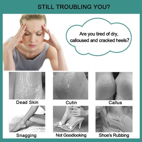 CAREHOOD Foot File Callus Remover - Multi Purpose 4 in 1 Feet Pedicure Tools with Foot Scrubber, Pumice Stone, Foot Rasp and Sand Paper for Home Foot Care (Grey Pedicure Foot File)