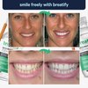 Breatify Teeth Whitening Gel, Natural Whiteness, Effective, Painless, No Sensitivity, Easy to Use, Removes Stains and Yellowing on The Teeth, 0.67 Fl Oz