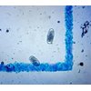 McMaster Method Microscope Slide - FEC (Fecal Egg Count) or Worm Count, Double Chamber Slide for Parasite Testing and Management in Horses, Sheep, Goats and Cattle