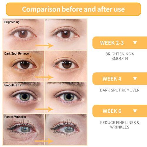 BREYLEE Vitamin C Serum for Face & Eye (1.4 oz) for Brightening Skin,Dark Spot Remover,Reduce Wrinkle,Anti Aging,Moisturizer with Hyaluronic Acid,Vitamin E,Retinol