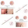 Blackhead Remover Pimple Comedone Extractor Tool Best Acne Removal Kit - Treatment for Blemish, Whitehead Popping, Zit Removing for Risk Free Nose Face Skin with Case (Rose)