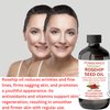 Premium Organic Rosehip Oil, Cold-Pressed & Unrefined, Organic Anti-Aging Face Oil, Reduces Wrinkles, Rich In Vitamin C, Retinol & Fatty Acids, Skin Care Moisturizer, Rosehip Face Oil