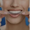 Crest 3D No Slip Whitestrips Professional Effects Teeth Whitening Kit 20 ea