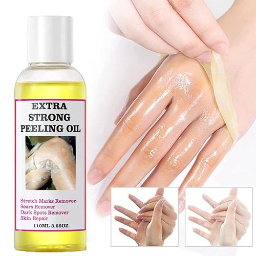 Peeling Oil for Dark Skin, Yellow Peeling Oil, Extra Strong Peeling Oil, Exfoliating Peeling Solution for Body All Skin Type -110ML/3.88 OZ