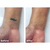 Dermaflage Tattoo Cover Up Bruise Full Coverage Concealer - Waterproof, Smudge & Sweat Proof Body Concealer Cream Palette Pro SFX - 3 Color Light Shades for Scars, Acne (Light)