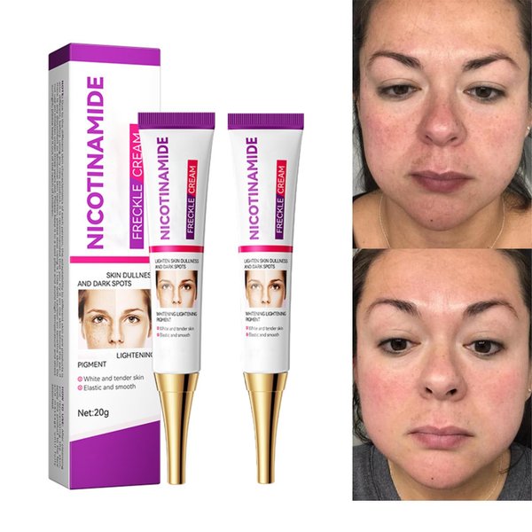Dark Spot Remover for Face and Body: Advanced Dark Spot Corrector Serum for Age Spot Sun Spot Freckles Brown Spot - Spot Correcting Serum for Face Hands, 20g/0.8 OZ (2 PCS)