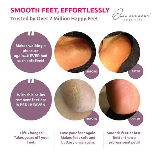 Own Harmony Professional Pedi Foot Care for Women: Rechargeable Pedicure Tools and Callus Remover for Feet Electric - Electronic Foot File Sander - Best for Hard Dry, Dead, Cracked Skin (3 Rollers)