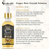 VedoAID Ginger Oil for Hair Growth - Biotin Hair Growth Serum, 100% Pure Natural Ginger Essential Oil - Promotes Stronger, Thicker, Longer Hair in Women & Men (1pc, Premium)