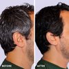 Colorsmith Hair & Beard Color for Full Gray Coverage 2 pack - Dark Intense Copper Blonde - Ammonia-Free Complete Men’s At-home Beard & Hair Dye Kit, Professional-grade Permanent Hair Color (7.40)