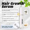 Hair Growth Serum Minoxidil Applicator - 15ML 5% Biotin Hair Growth Oil Scalp Massager Serum Non-Greasy for Women & Men, Hair Loss Treatments, Hair Regrowth Treatment