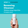 Proactiv 3 Step Acne Treatment - Benzoyl Peroxide Face Wash, Repairing Acne Spot Treatment for Face and Body, Exfoliating Toner - 30 Day Complete Acne Skin Care Kit