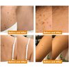 iYanoc 2 PCS Bee Venom Cream, Professional Bee Venom Repair Cream, New Bee Venom Treatment Cream, Hydrating Moisturizing Cream for Men and Women, Suitable for All Skin Types
