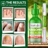 Toenail Fungus Treatment Extra Strength - Antifungal Pen – Fingernail Repair - 7 Day Visible Change on Damaged, Thick, Discolored Nails - Tea Tree Oil