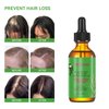 Rosemary Hair Growth Oil and Serum - Dry Scalp Treatment, Hair Thickening Products for Women, Hair Loss Essential Oils for Diffuser (2OZ)