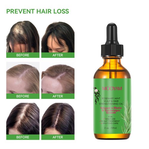 Rosemary Hair Growth Oil and Serum - Dry Scalp Treatment, Hair Thickening Products for Women, Hair Loss Essential Oils for Diffuser (2OZ)