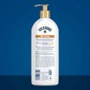 Gold Bond Softening Hydrating Lotion, 20 oz., With Shea Butter for Rough & Dry Skin