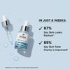 IT Cosmetics Bye Bye Dark Spots 4% Niacinamide Serum - Visibly Reduces Dark Spots & Improves Skin Clarity In 8 Weeks - With 1% Ethyl Vitamin C - For All Skin Types - 1 fl oz
