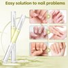 Radiant Nail Growth GIL, Radiant Nail Growth Oil Pen,Cuticle Oil for Nails,Nail Strengthener, For Moisturize Strengthen Nail Care Oil, Finger Edge Manicure Nourishing Pen, Nail Skin Edge Care(4PCS)