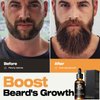 Waking Forest Beard Oil, [Thicker Beard] Beard Growth Oil Sandalwood with Vitamin E、Rosemary、Castor、Argan、Almond Gifts for Men