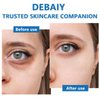DEBAIY 3 Pack Anti-Wrinkle Eye Cream with Caffeine & Peptides - Reduces Dark Circles & Puffiness, Improves Skin Texture (Each 0.529oz | 15g)