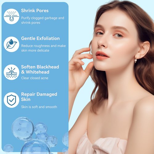 Niacinamide 10% + Zinc 1% Face Serum, Oil Control and Acne Treatment Niacinamide Facial Serum,Refreshing Serum for Face, 30ML/1 Fl Oz