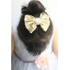 Missgrace Hot Gold Hair Bow.Hair Bows, Hair Clips,Girls Hair Bows.Hair Bows