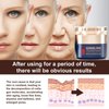 QINGLING Face Cream, Qingling Wrinkle Removal Cream, Peptide Firming Anti-Wrinkle Facial Cream, Anti aging Moisturizer SkinCare Cream