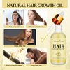 Natural Hair Growth Oil with Rosemary Batana Oil Biotin for Hair Loss and Thinning Hair, Hair Growth Serum for Dry Damaged Hair, Veganic Hair Growth Oil with Caffeine for Strong Roots and Thick Hair