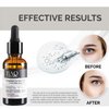 BAO Laboratory Persephone Eye Serum Oil | Sacha Inchi Oil, Bisabolol and Vitamin C & E | Eye Serum for Wrinkles, Finelines and Dark Circle (30 ML)