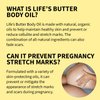 Life's Butter Body Oil with Jojoba Oil, Sweet Almond Oil, Sunflower Oil, Grapeseed Oil for Scars and Stretchmarks, Body Oil for Pregnancy Improves elasticity and Visibily Firms and Tones | 100% Natural