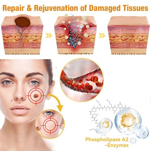 iYanoc 2 PCS Bee Venom Cream, Professional Bee Venom Repair Cream, New Bee Venom Treatment Cream, Hydrating Moisturizing Cream for Men and Women, Suitable for All Skin Types